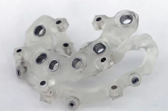 福嶋歯科医院のインプラント治療の特徴