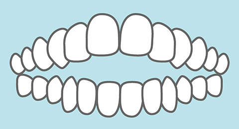 開咬（かいこう）