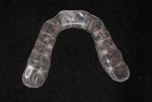 Bite-Plate