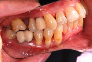 orthodontic-treatment-1