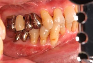 orthodontic-treatment-6