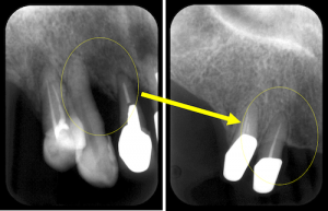 perio-tissue-regeneration