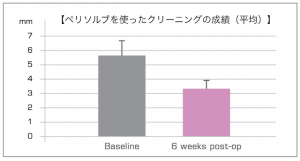 Perisolve-4