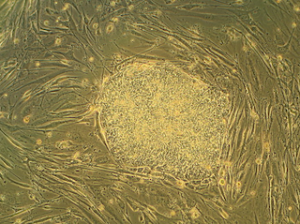 human embryonic stem cells