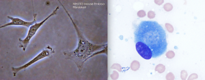 線維芽細胞と骨芽細胞