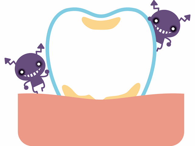 歯周病の原因「プラーク」とは？？