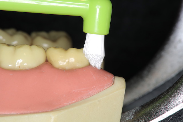 歯周病予防に効果的なワンタフトブラシの特徴と選ぶ基準