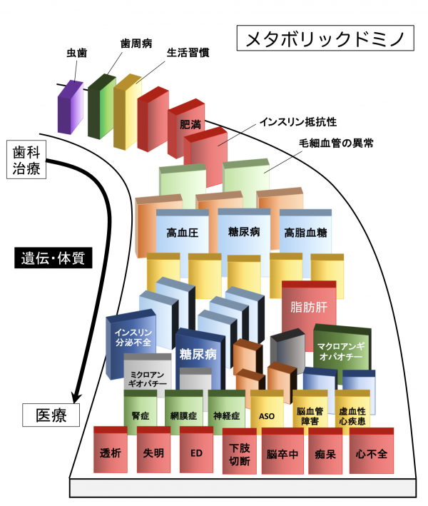 歯周病はメタボリックドミノのはじまり