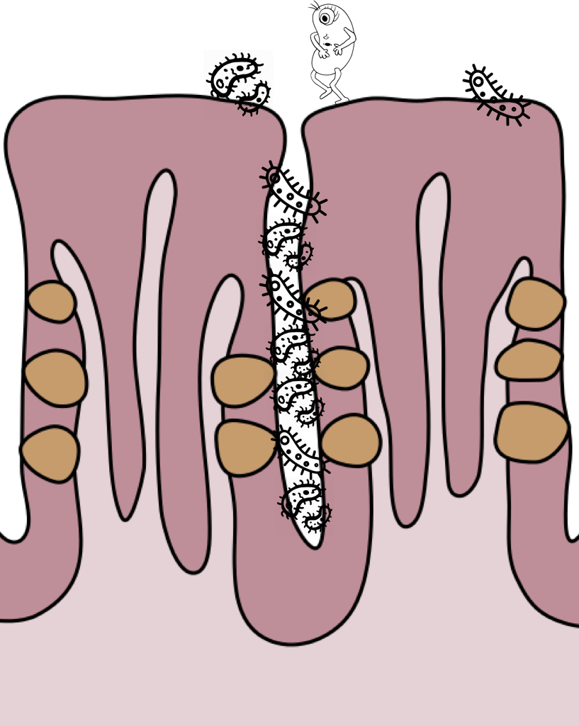歯周病予防に効果的な舌ブラシ