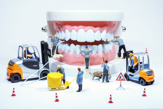 歯周外科治療後の注意事項