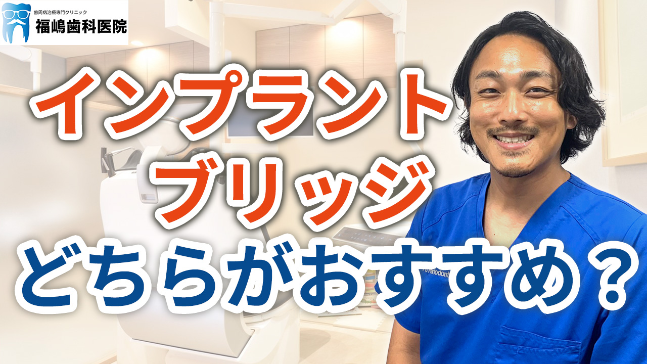 インプラントとブリッジどちらがおすすめか？
