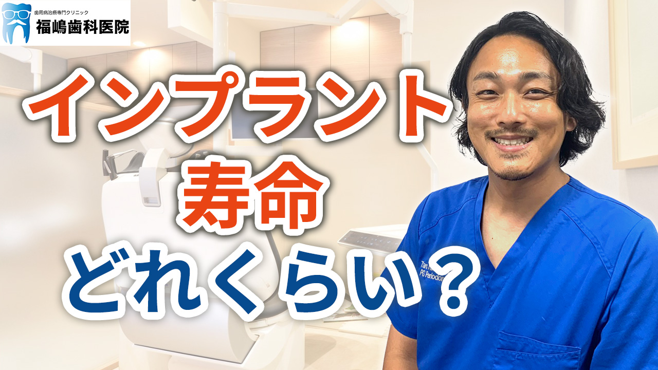 インプラントの寿命はどれくらい持つか？