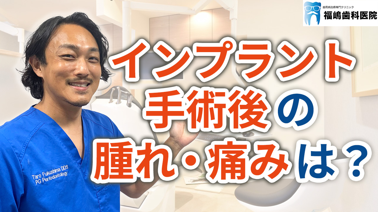 インプラント治療の手術後は腫れや痛みはどれくらいか？