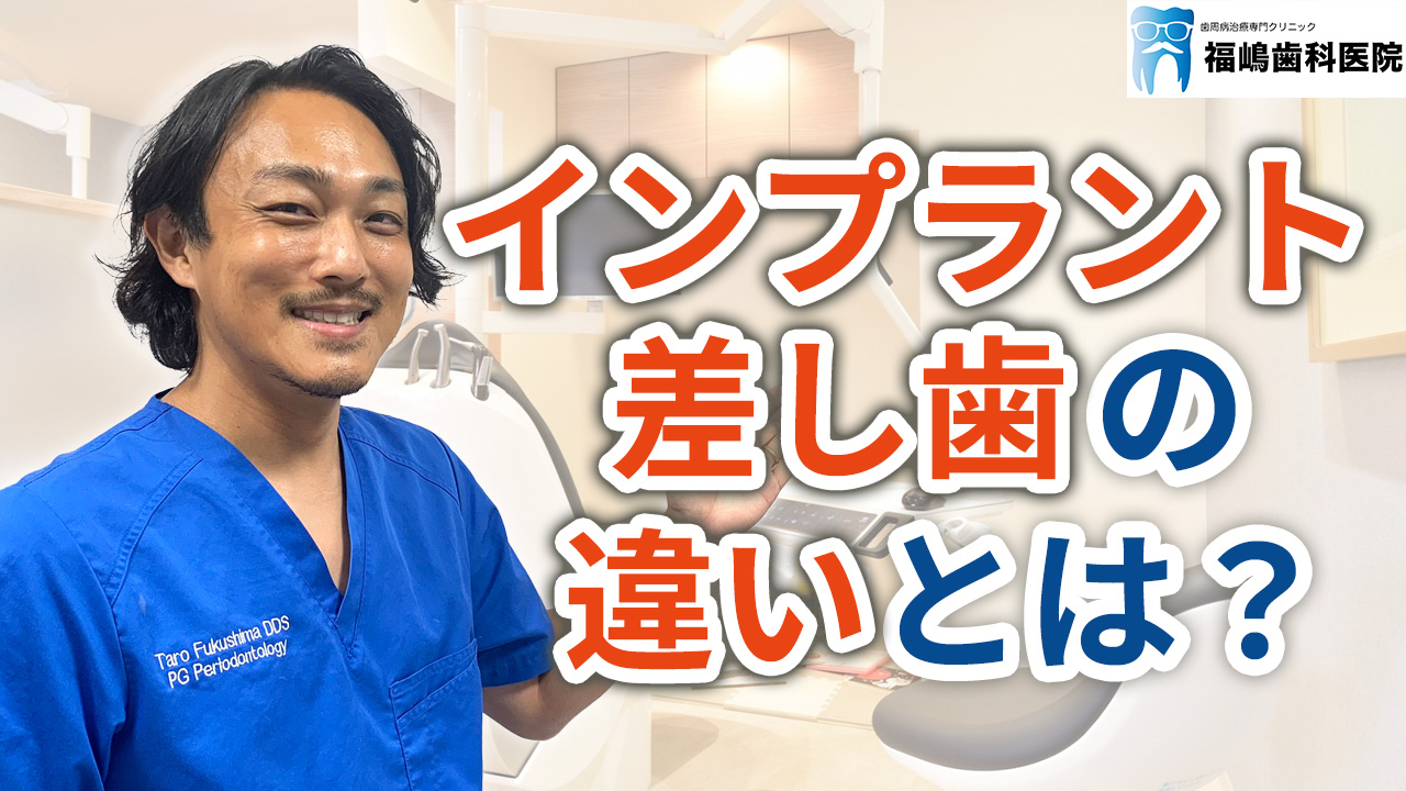 インプラントと差し歯の違いとは？