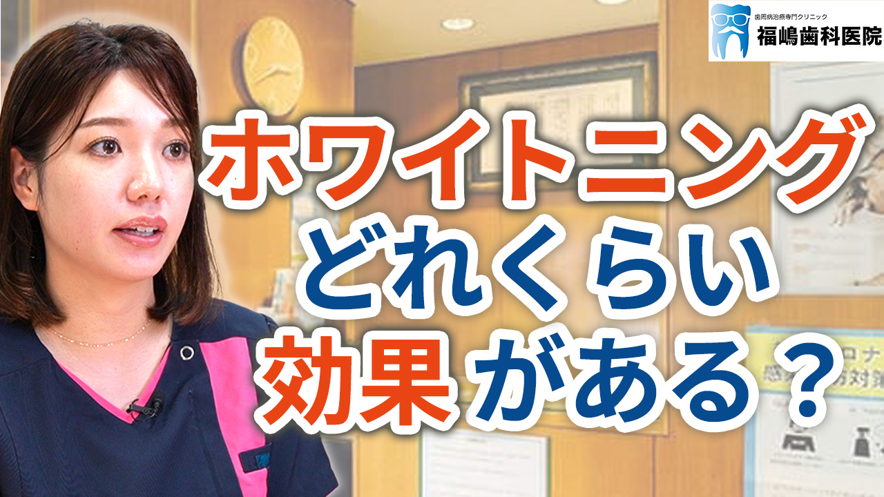 ホワイトニングってどれくらい効果があるのか？