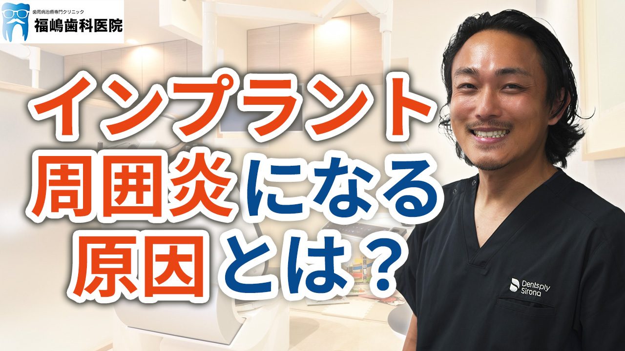インプラント周囲炎になる原因とは？