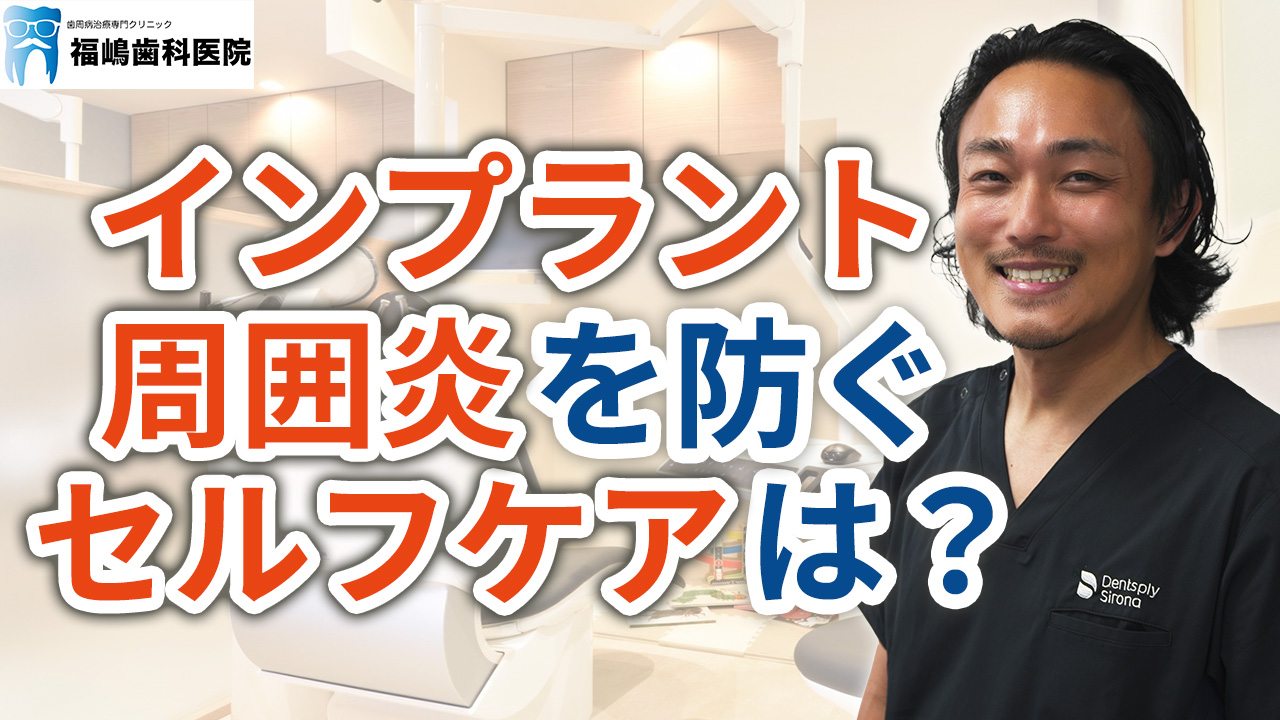 インプラント周囲炎を防ぐセルフケア方法とは？