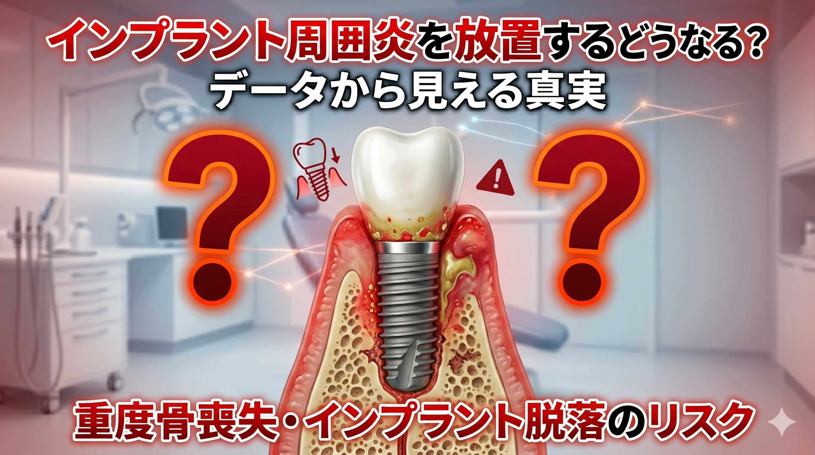 インプラント周囲炎を放置するとどうなる？